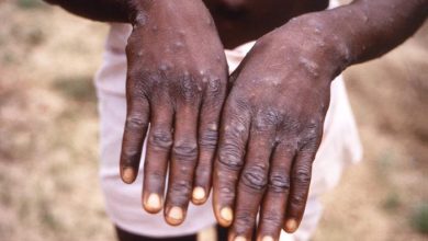 who-calls-for-‘urgent’-action-in-europe-over-monkeypox