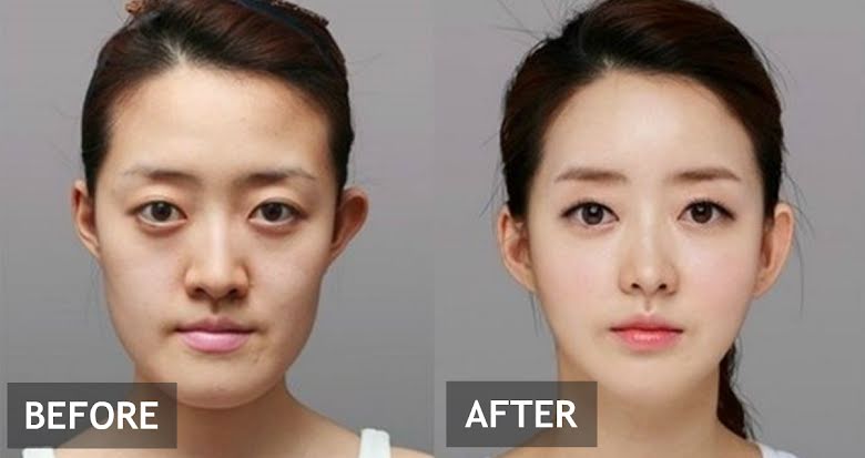 why-south-korea-is-the-plastic-surgery-capital-of-the-world