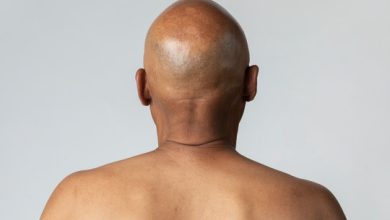 hair-loss:-4-home-remedies-to-get-rid-of-baldness