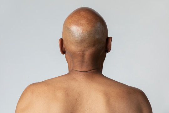 hair-loss:-4-home-remedies-to-get-rid-of-baldness