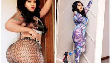 vera-sidika-undergoes-surgery-to-reduce-her-booty-after-health-complications