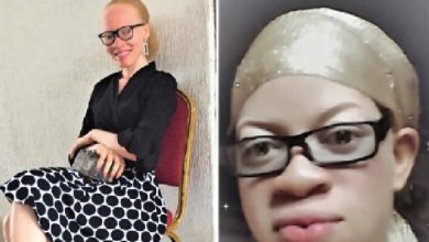 ngo-condemns-skits-stigmatising-albinos