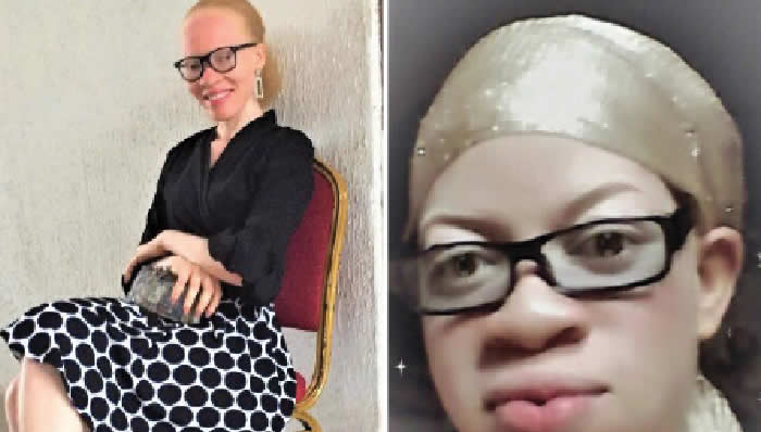 ngo-condemns-skits-stigmatising-albinos