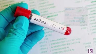 fg-confirms-first-case-of-anthrax-in-nigeria