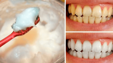 how-to-naturally-whiten-your-teeth-at-home-using-baking-soda-and-coconut-oil