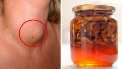 improve-your-thyroid-gland-function-with-this-honey-and-walnuts-recipe