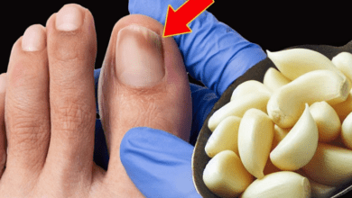 this-is-a-solution-for-nail-fungus-(it-works-very-fast):-garlic!