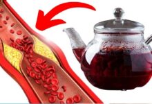 1-cup-a-day:-the-wonders-of-hibiscus-tea-for-dissolving-blood-clots