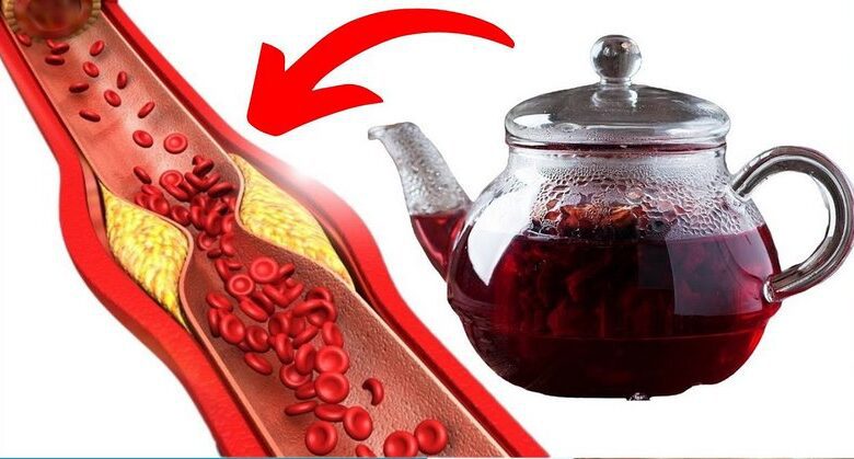 1-cup-a-day:-the-wonders-of-hibiscus-tea-for-dissolving-blood-clots