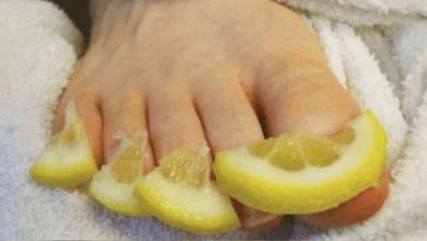 lemon:-a-natural-remedy-for-combating-toenail-fungus