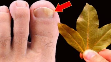 get-rid-of-nail-fungus-with-just-bay-leaves!-you-don’t-need-to-spend-extra-money-at-the-pharmacy!