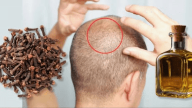 at-75,-hair-grows-on-a-bald-spot!-how-clove-oil-can-stimulate-hair-growth