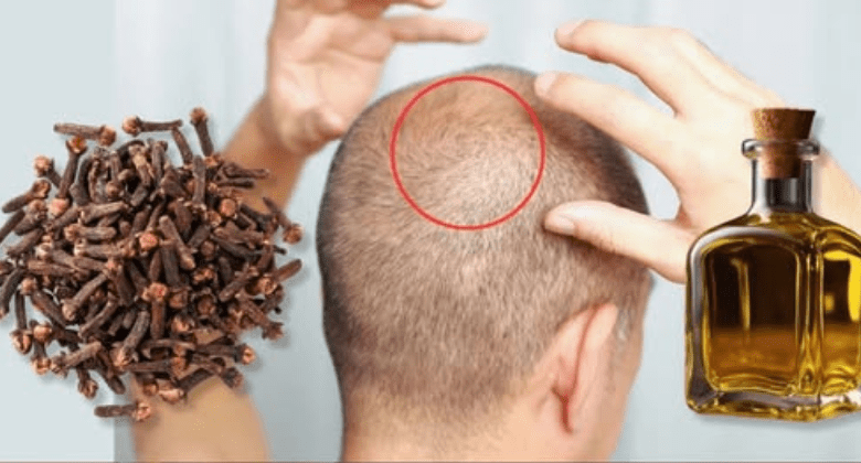 at-75,-hair-grows-on-a-bald-spot!-how-clove-oil-can-stimulate-hair-growth