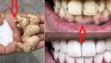 transform-your-smile:-the-ultimate-teeth-whitening-method-unveiled