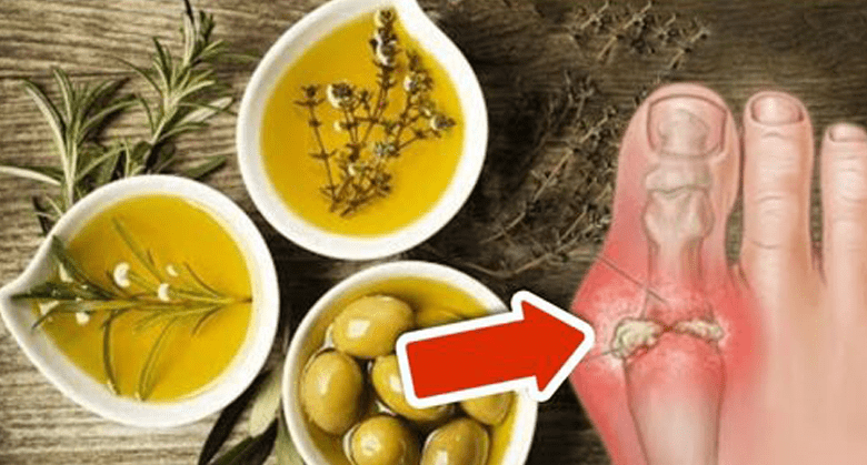 8-easy-ways-to-remove-excess-uric-acid(easier-than-you-think)