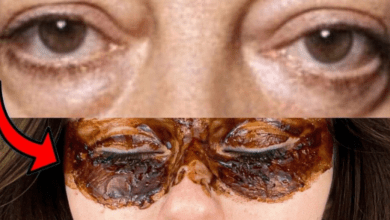 how-to-remove-bags-under-eyes:-a-quick-and-effective-method