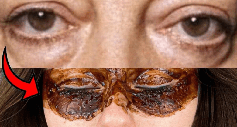 how-to-remove-bags-under-eyes:-a-quick-and-effective-method