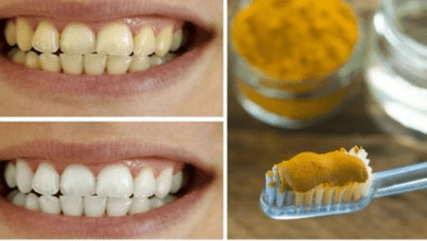 discover-how-turmeric-can-transform-your-life-and-enhance-your-dental-health-naturally