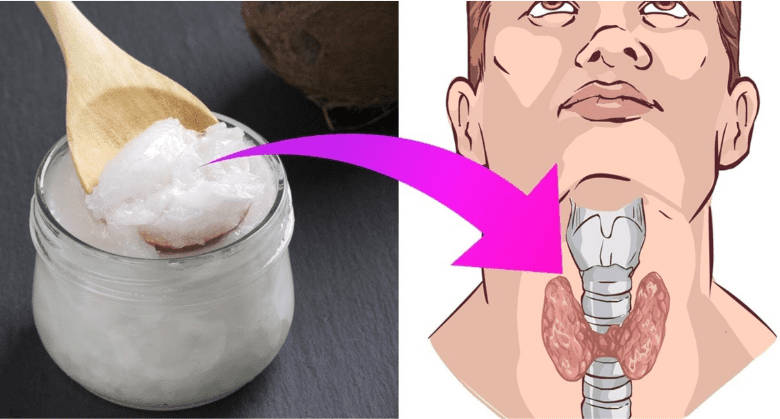 6-ways-coconut-oil-can-benefit-those-with-thyroid-problems