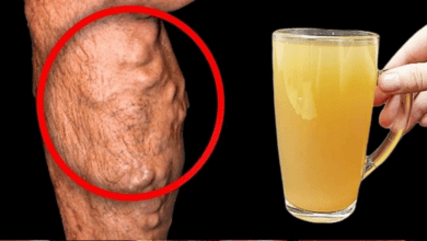 apple-and-lemon-juice-quickly-dissolve-blood-clots-and-make-the-blood-fluid!