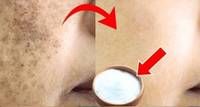 saying-goodbye-to-age-spots:-how-baking-soda-paste-became-my-secret-weapon