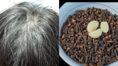 reverse-white-hair-naturally-with-just-two-ingredients:-garlic-and-clove