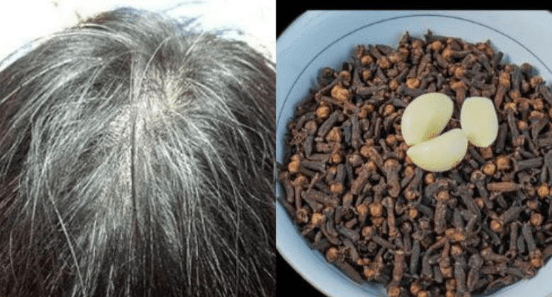 reverse-white-hair-naturally-with-just-two-ingredients:-garlic-and-clove