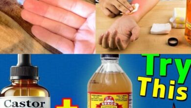 mixing-castor-oil-with-apple-cider-vinegar-can-trigger-this-irreversible-body-reaction!