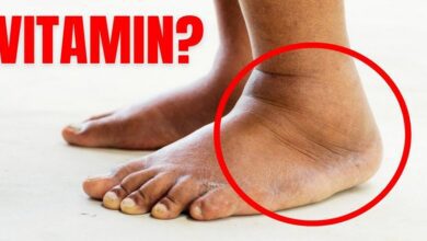 no.-1-vitamin-for-removing-swelling-from-the-body!