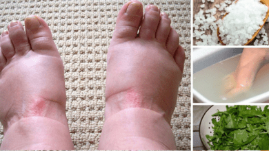 home-remedies-for-swollen-feet