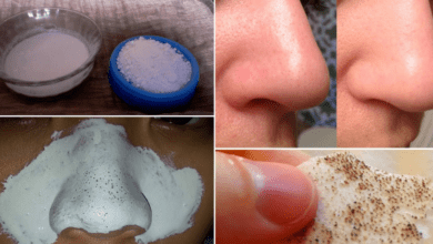 how-to-remove-blackheads-naturally-with-toothpaste