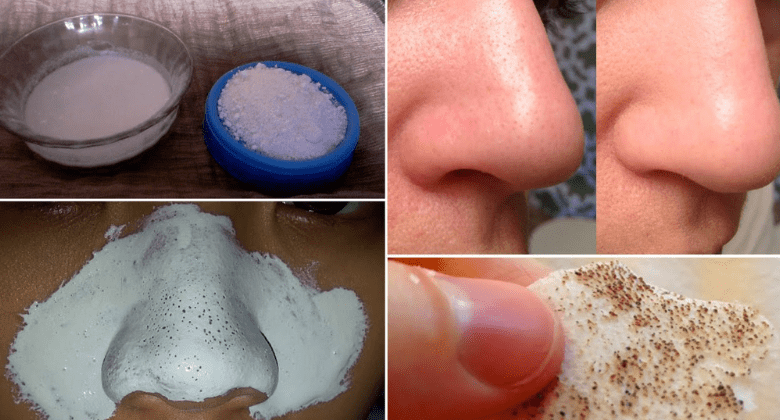 how-to-remove-blackheads-naturally-with-toothpaste