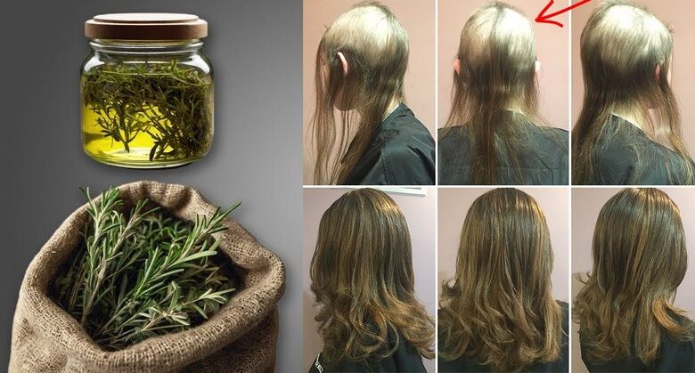 hair-in-this-family-grows-like-craz.y!-rosemary-black-oil-triggers-significant-hair-growth