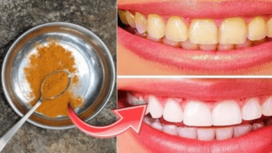 secret-that-dentists-don’t-want-you-to-know:-remove-tartar-and-whiten-teeth-using-turmeric