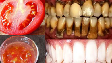 the-strongest-teeth-whitening-recipe-at-home-in-2-minutes:-whitening-yellow-teeth-from-tartar-naturally-with-tomatoes-and…-