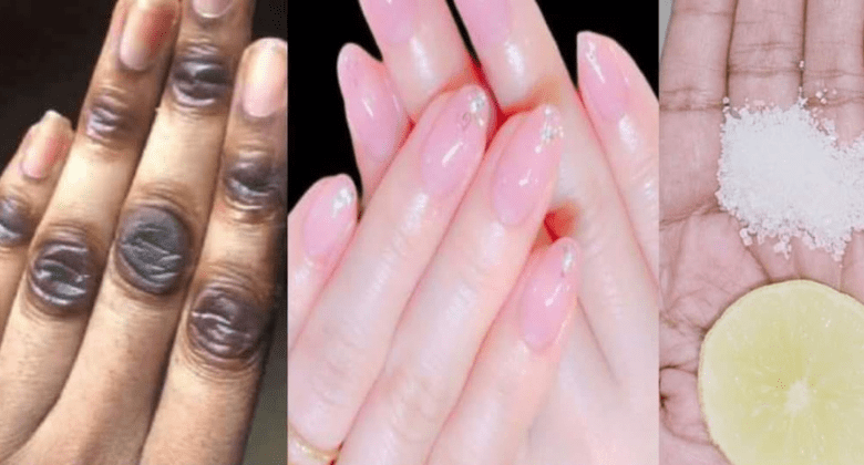 discover-the-secrets-to-naturally-whiter-hands-at-home