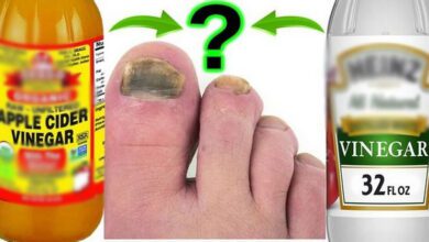 white-vinegar-vs.-apple-cider-vinegar-for-toenail-fungus:-which-is-better?