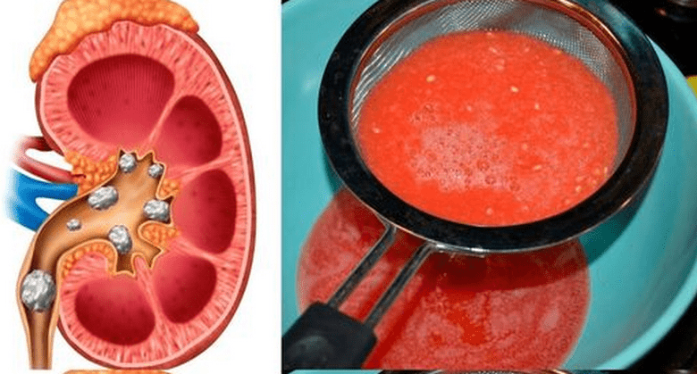 how-to-cleanse-&-detox-your-kidneys-naturally-with-tomato-juice