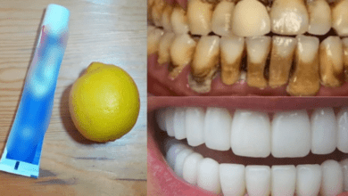 natural-mixture-for-whitening-yellow-teeth-at-home