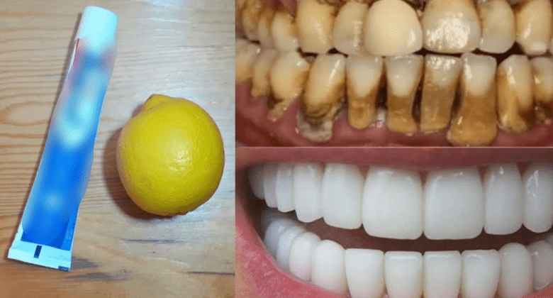 natural-mixture-for-whitening-yellow-teeth-at-home