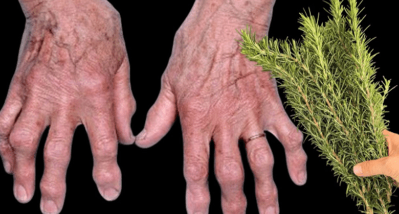 apply-rosemary-to-your-joints:-feel-young-and-energized-again!