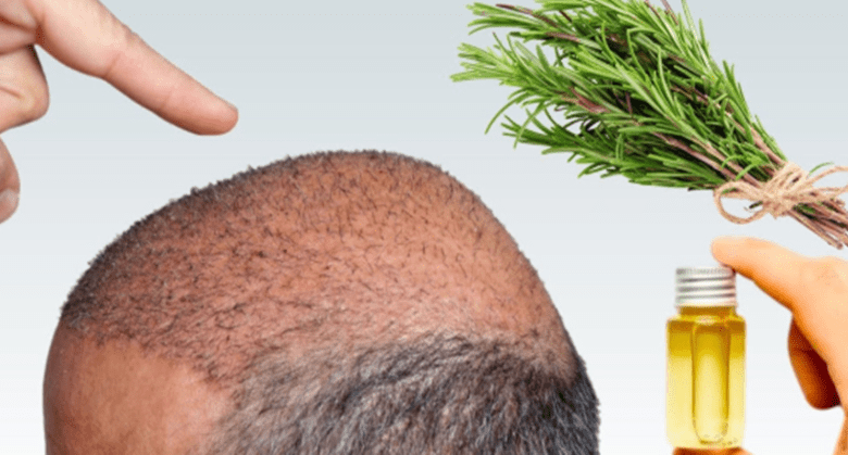 rosemary-hair-butter-for-extreme-hair-growth