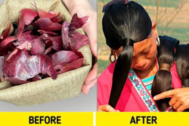 unlock-the-secret-to-strong,-healthy-hair-with-onion-peels