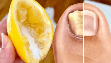 nail-fungus-removal:-natural-treatment-for-toenail-fungus-with-lemon-and-salt