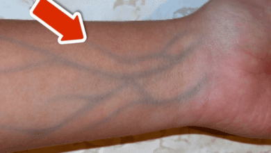 5-signs-of-poor-circulation-you-should-never-ignore-(important)-