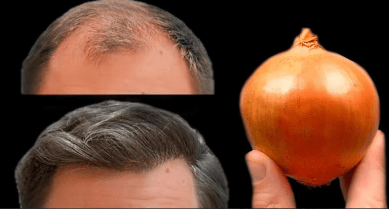 a-miracle-for-hair-growth:-the-power-of-onions!