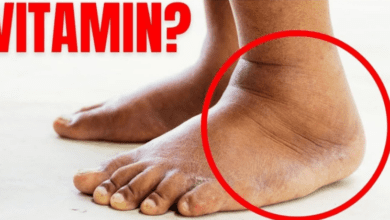 this-vitamin-removes-swelling-in-the-feet-and-legs-