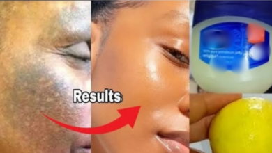 discover-the-astonishing-beauty-benefits-of-vaseline-and-lemon