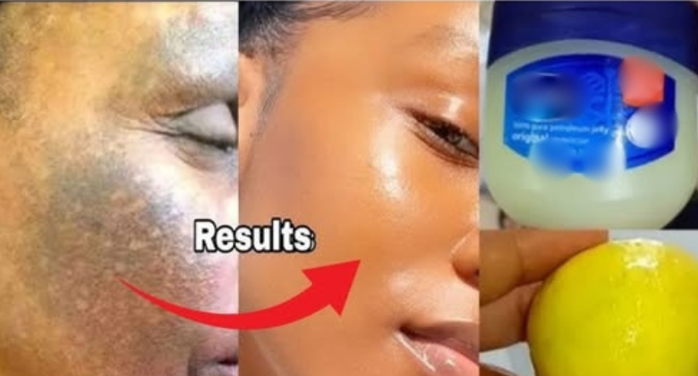 discover-the-astonishing-beauty-benefits-of-vaseline-and-lemon