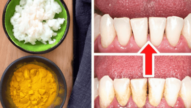 how-to-remove-tartar-and-plaque-from-your-teeth-without-a-dentist:-turmeric-and-salt